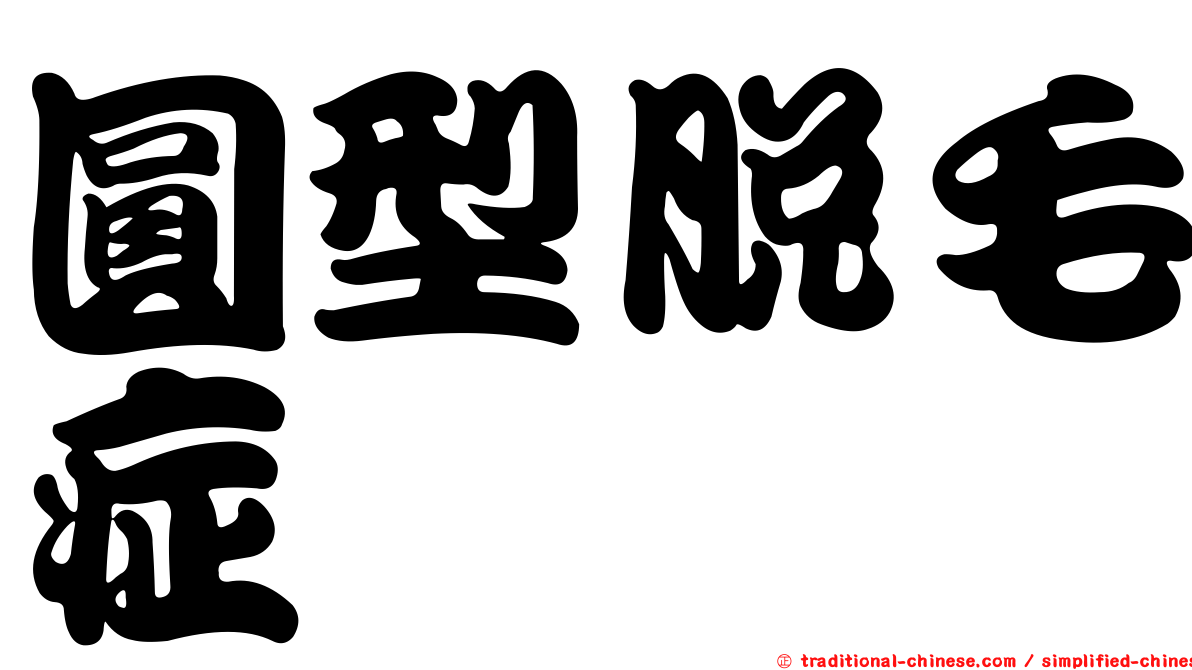 圓型脫毛症