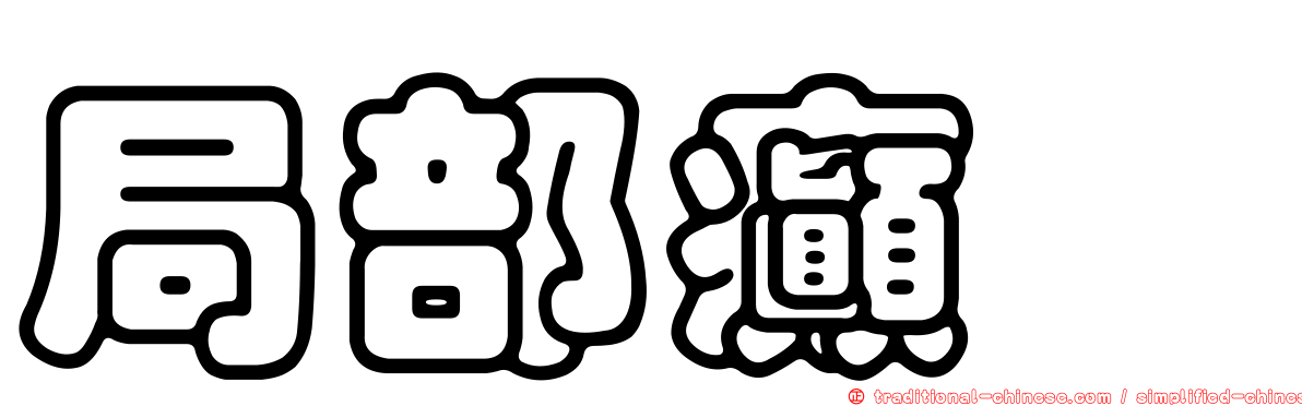 局部癲癇