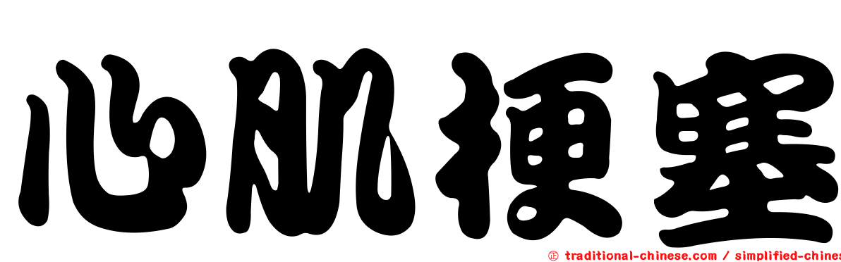 心肌梗塞