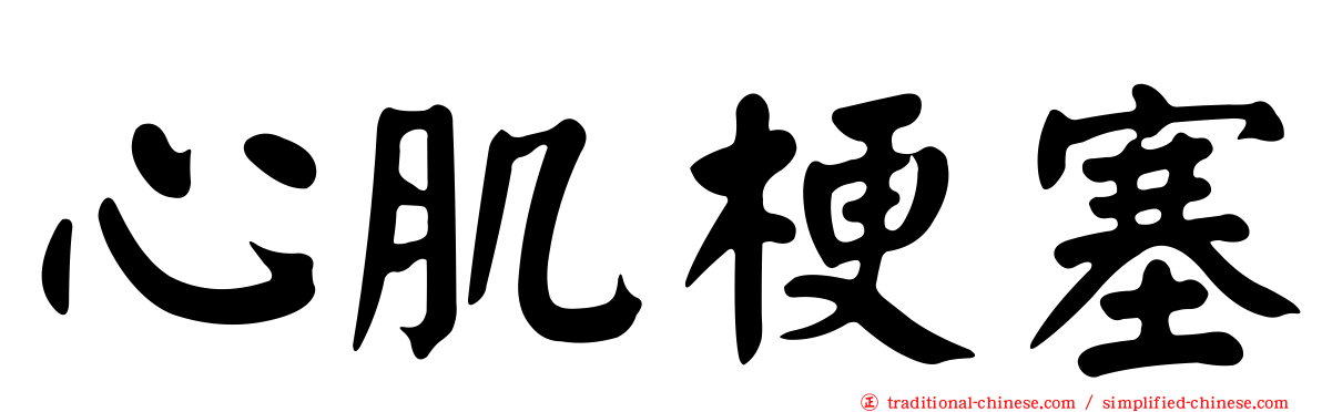 心肌梗塞
