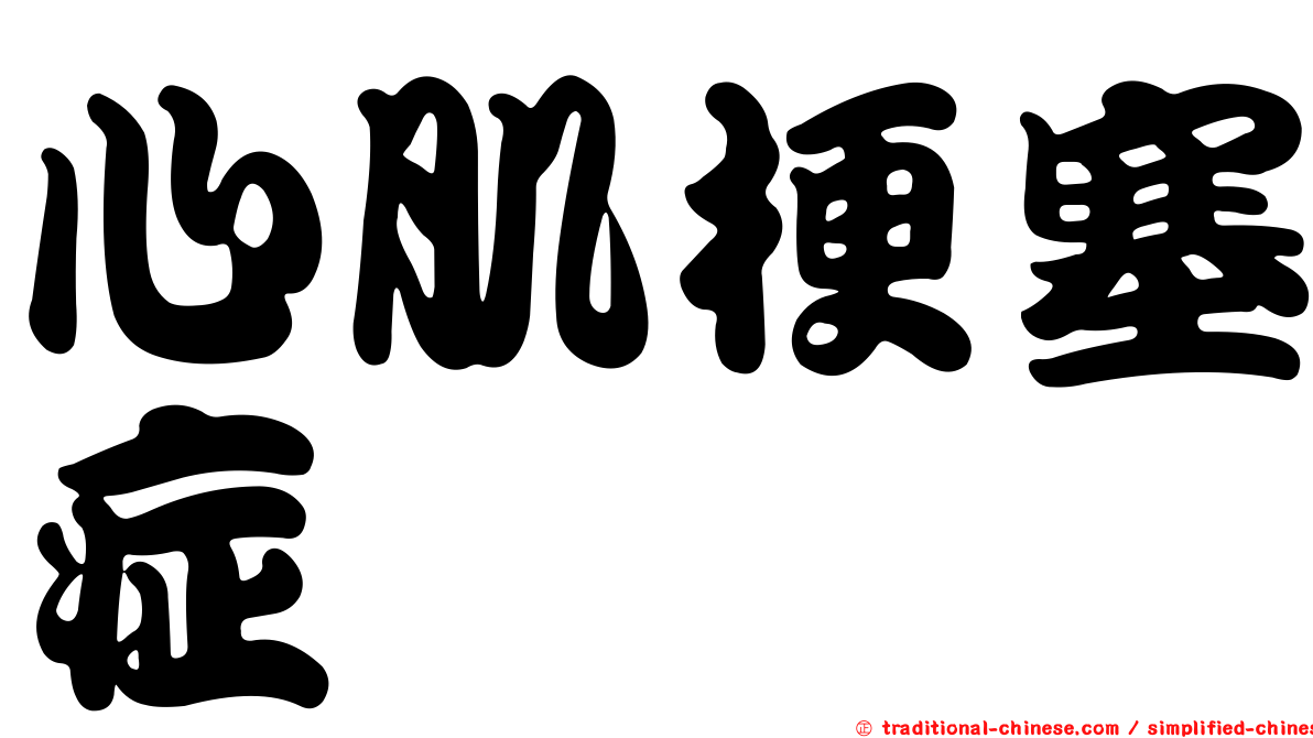 心肌梗塞症