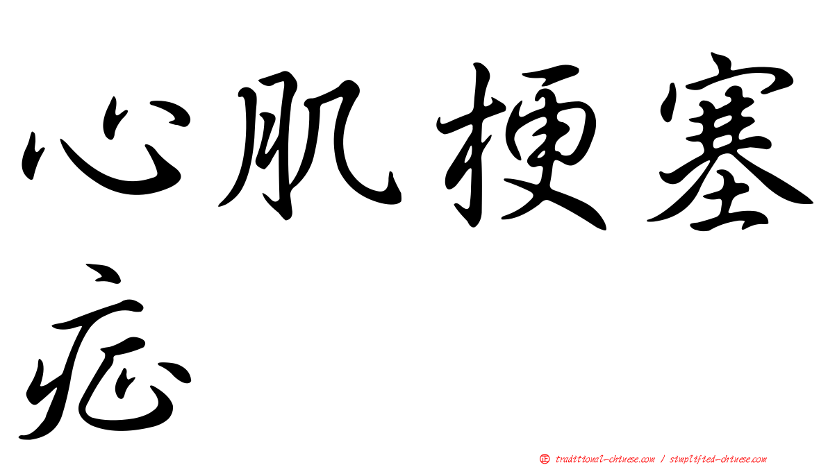 心肌梗塞症