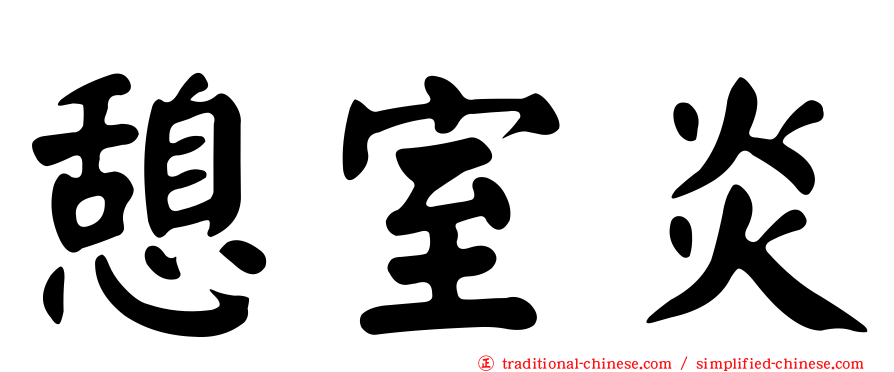 憩室炎