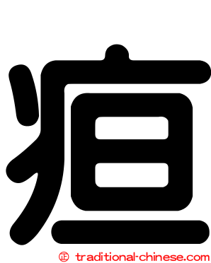 疸