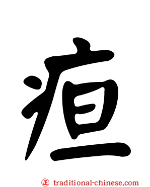 疸
