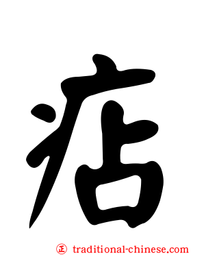 痁