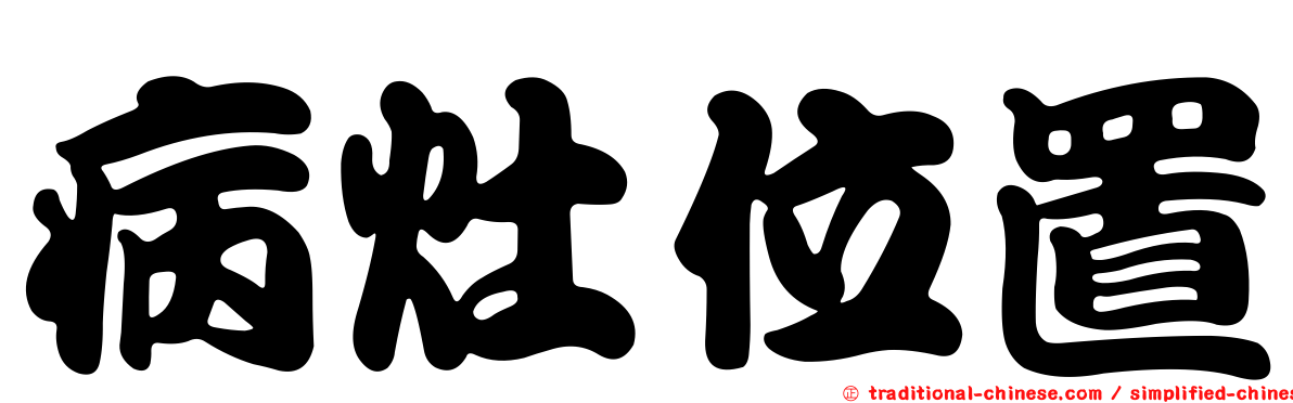 病灶位置