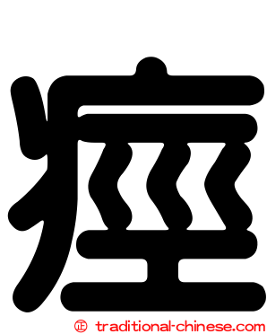 痙
