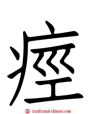 痙