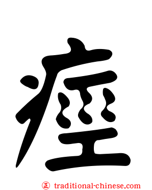 痙