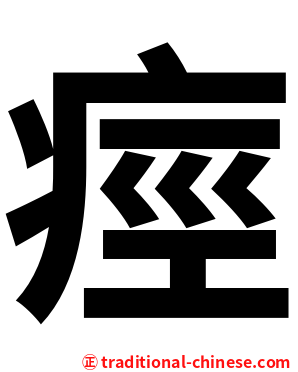 痙