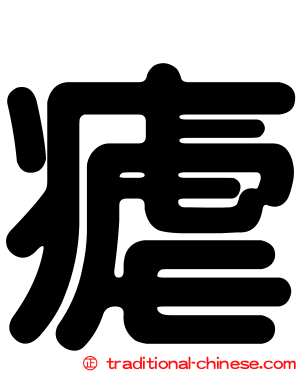 瘧