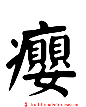 癭