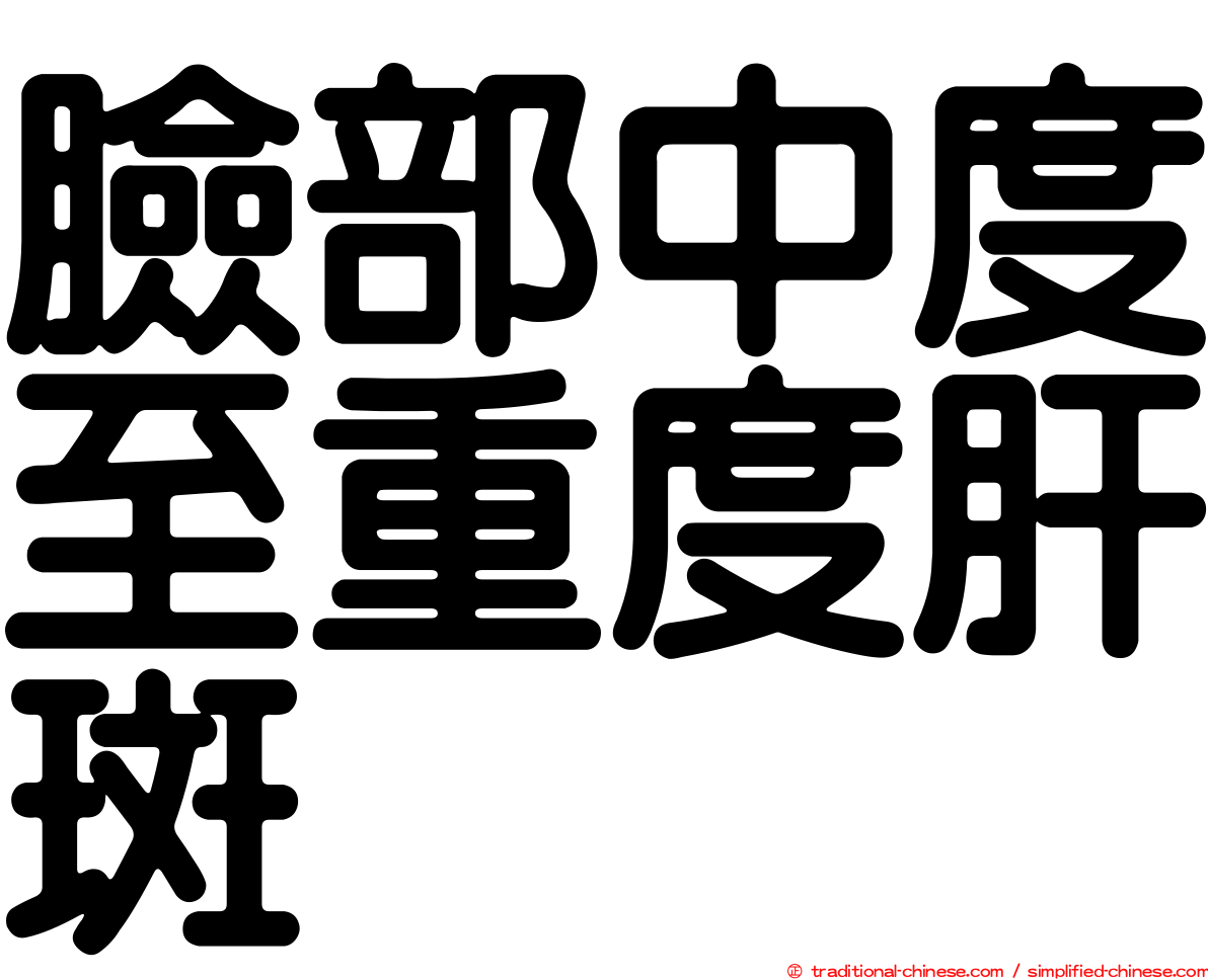 臉部中度至重度肝斑