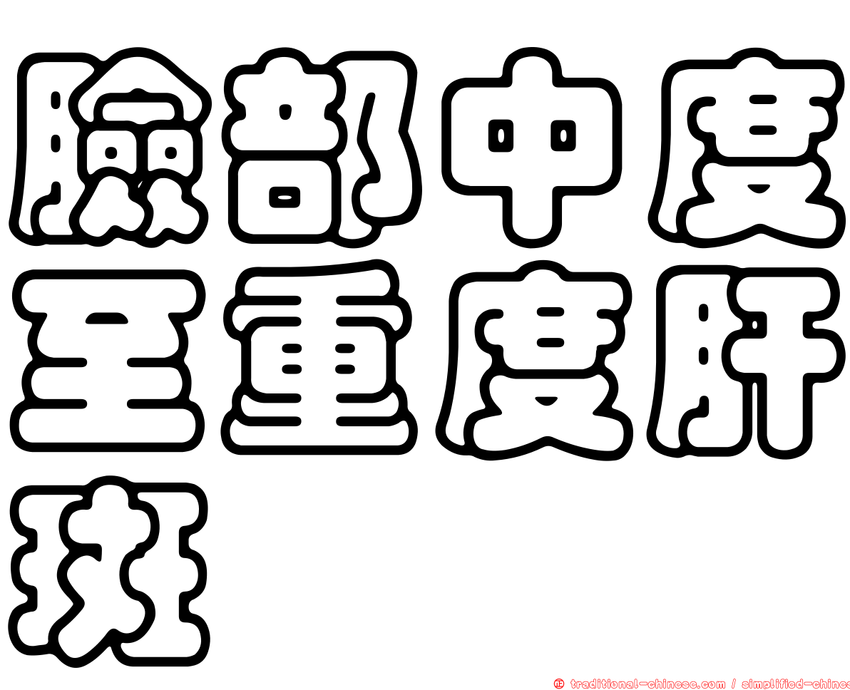臉部中度至重度肝斑