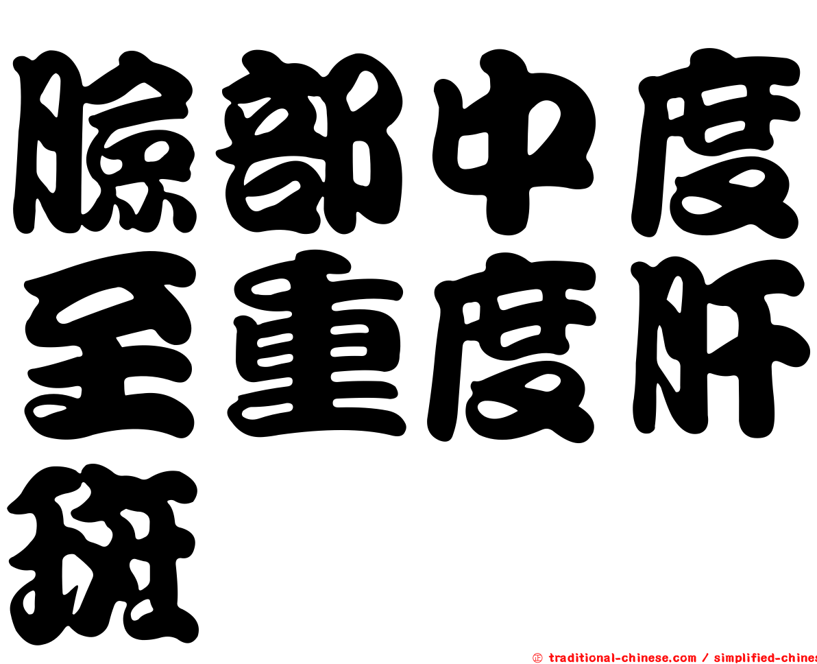臉部中度至重度肝斑