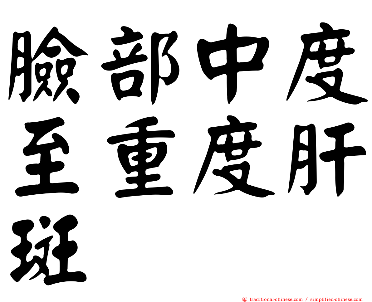 臉部中度至重度肝斑