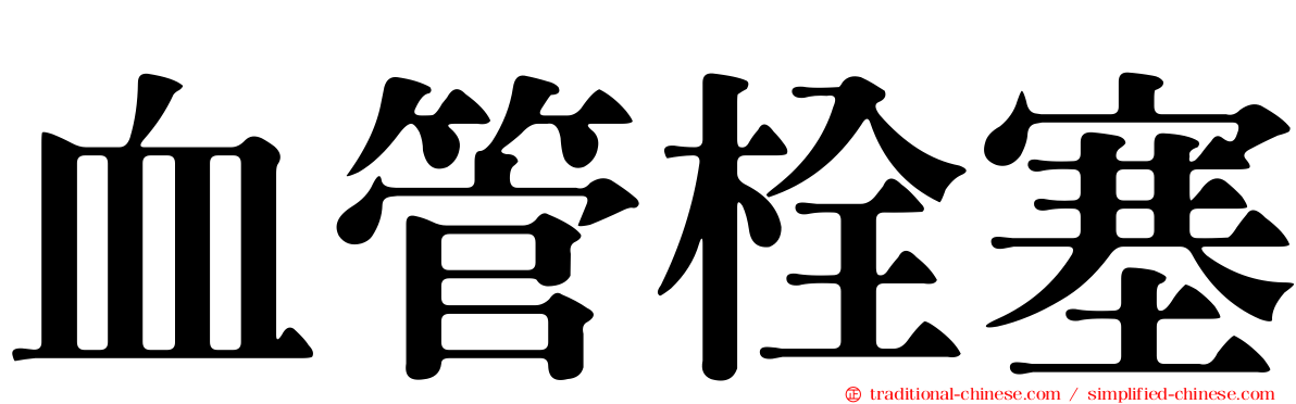 血管栓塞