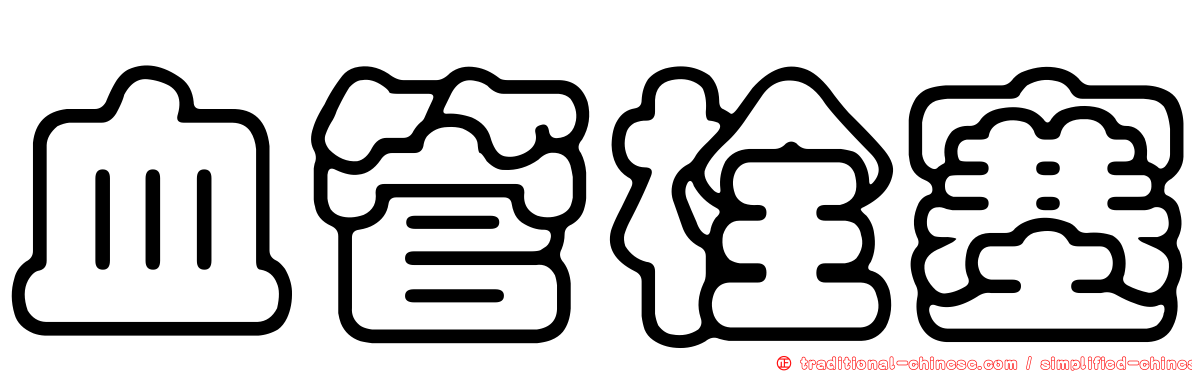 血管栓塞