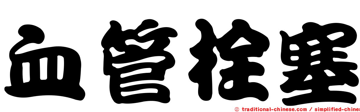 血管栓塞