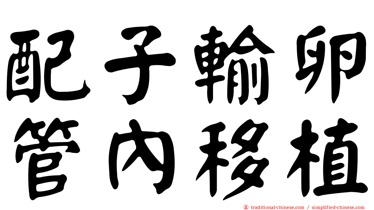 配子輸卵管內移植